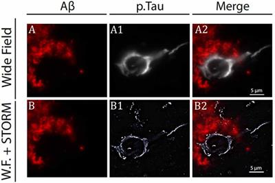 Molecular Imaging of Tau Protein: New Insights and Future Directions